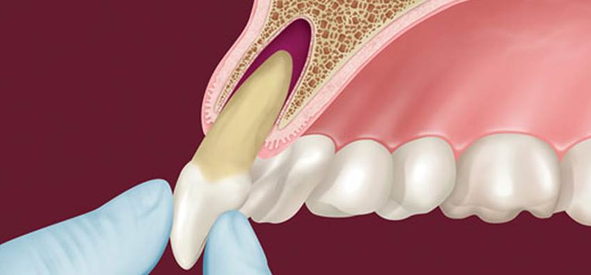Строение альвеолы зуба