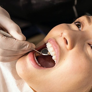 Желтый налет на зубах: причины и лечение