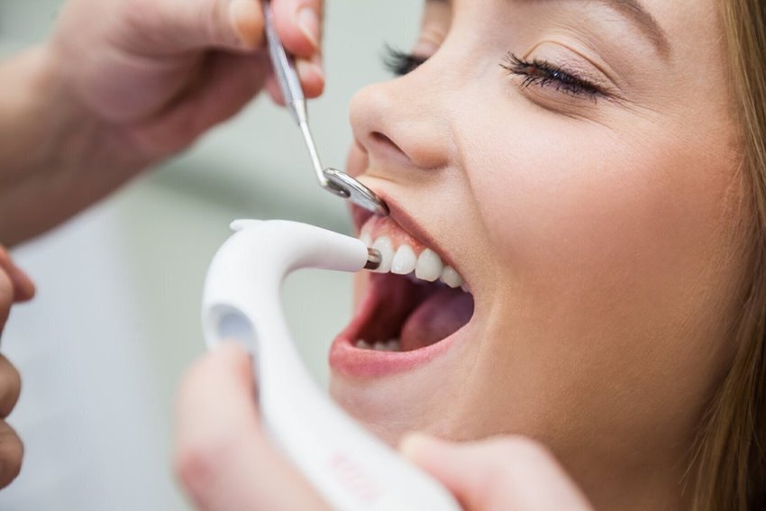 Как избежать повреждения передних зубов