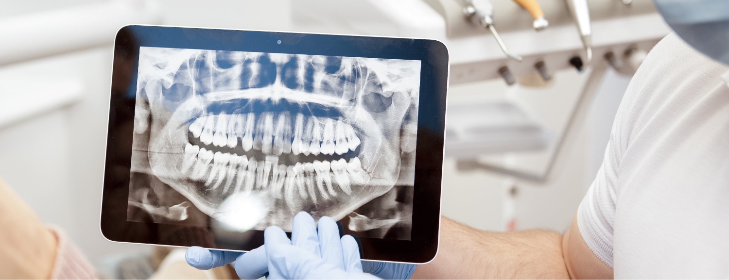 Насколько вреден рентген в стоматологии