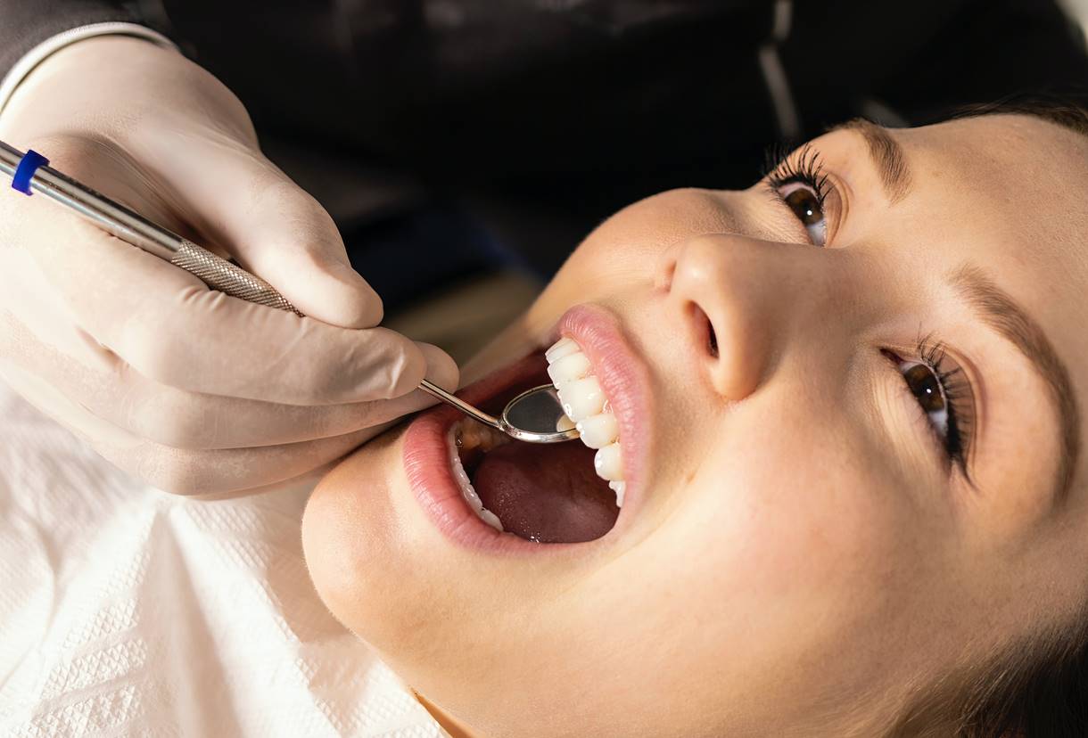 Желтый налет на зубах: причины и лечение
