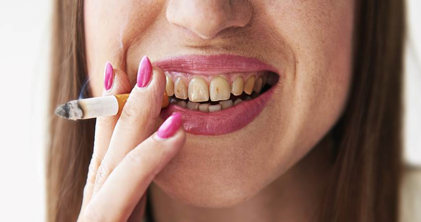 Причины появления темных пятен на зубах