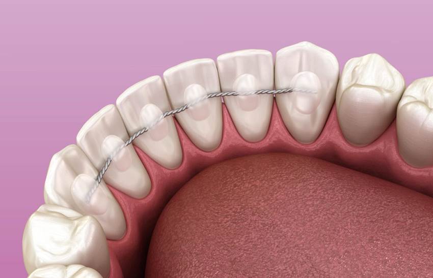 Комплексный стоматологический подход при лечении пародонтита
