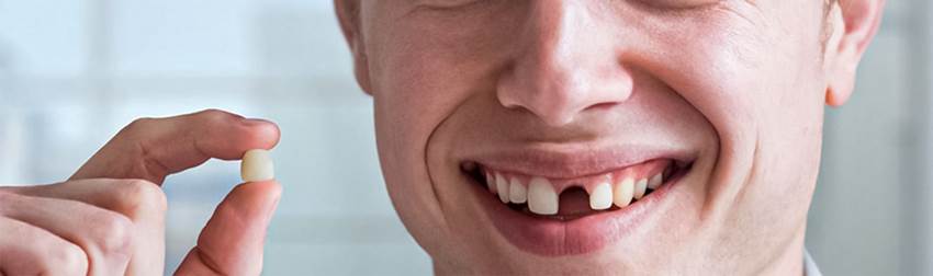 Симптомы скорого выпадения зуба