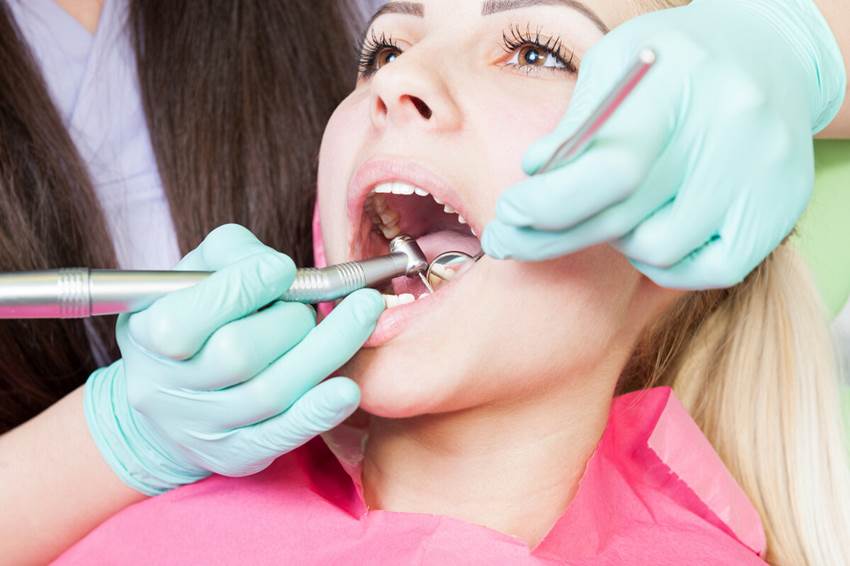 Методы удаления зубного камня 