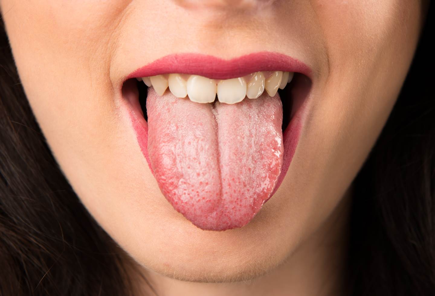 3 совета как убрать налет с языка