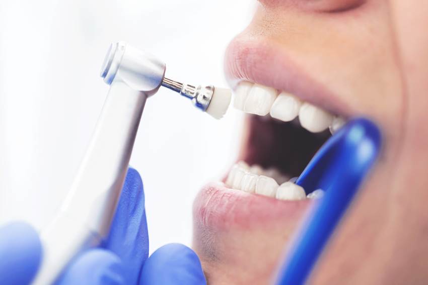 Этапы профессиональной гигиены зубов и полости рта