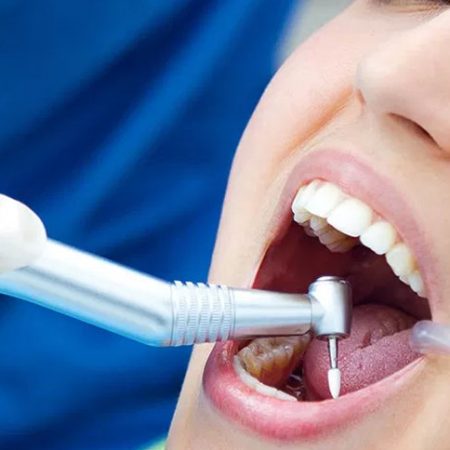 Показания к санации полости рта