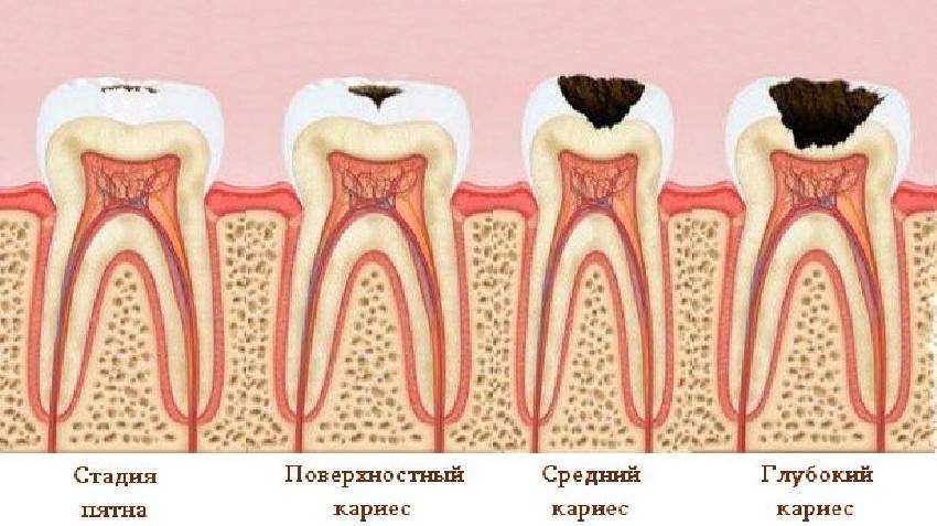 Я – стоматофоб! 10 страшных вопросов о лечении зубов