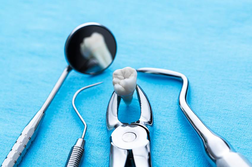 Методы лечения абсцесса зуба
