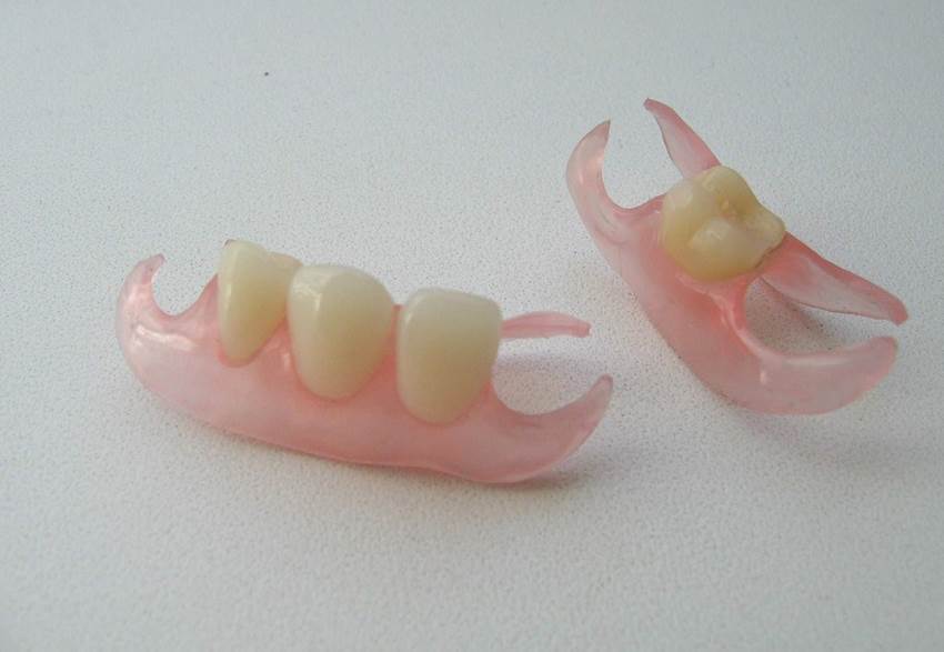 Важность замены удаленного зуба временным протезом