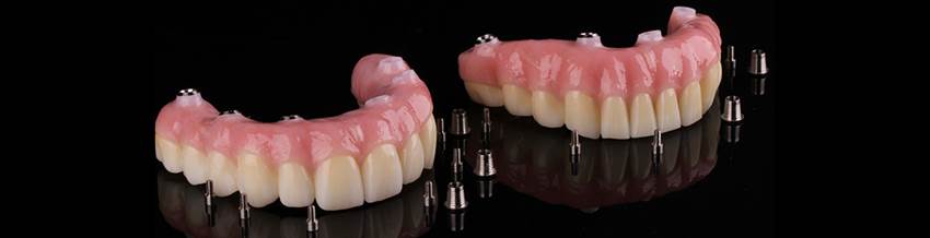 Замена зубов съемными протезами