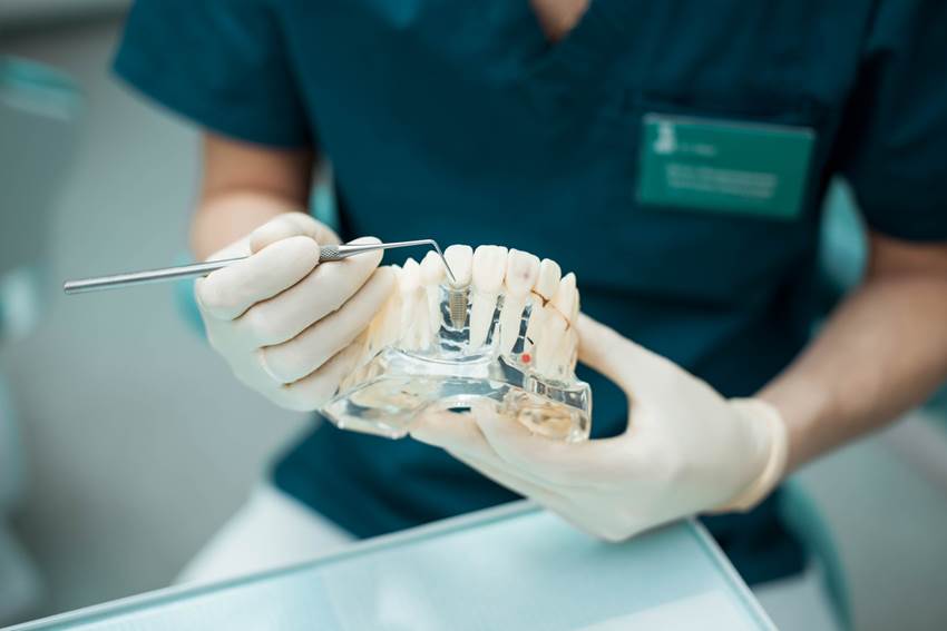 Сколько занимает установка импланта зуба