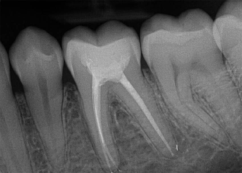 Информация о стоматологическом рентгене: ответы на вопросы