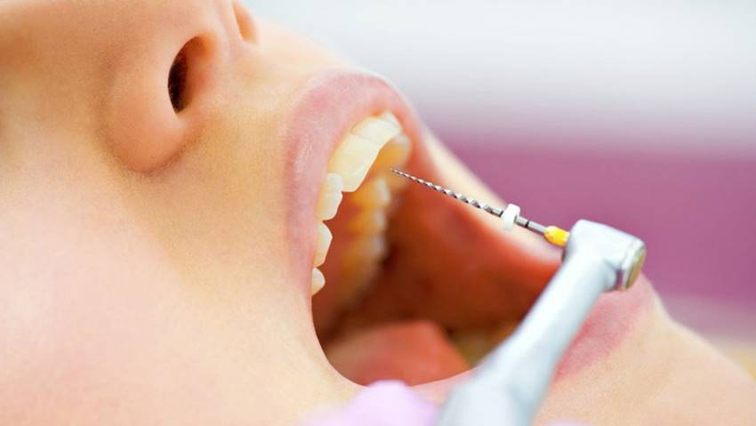 Срок службы зуба после удаления нерва