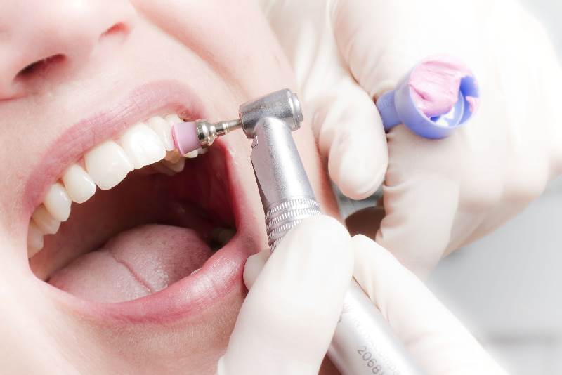 Показания и противопоказания к полировке зубов