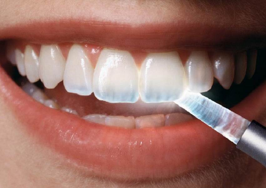 Прозрачные кончики зубов у взрослых