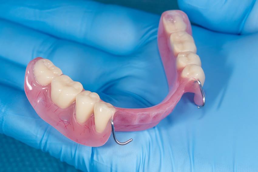 Показания и противопоказания к имплантации нижних зубов