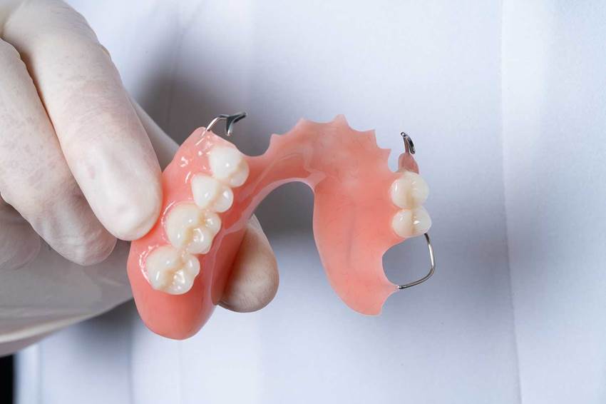 Как держатся съемные зубные протезы