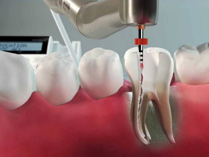Характеристика зубной ткани после удаления