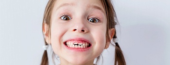 Смена молочных зубов постоянными: оптимальный возраст