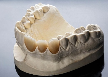 Металлокерамические зубы: преимущества и недостатки