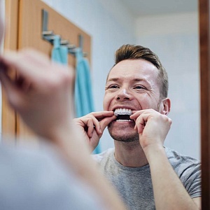 Выпирающие зубы: причины появления и способы коррекции