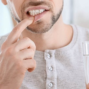 Боли после чистки зубов: причины и способы устранения
