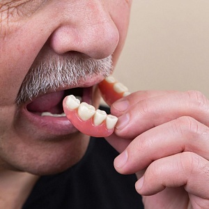 Чем заменить зубы: от временных протезов до имплантов