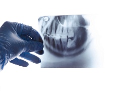 Зачатки зубов и этапы их формирования