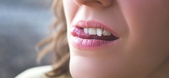 Подвижность зубов: причины и лечение